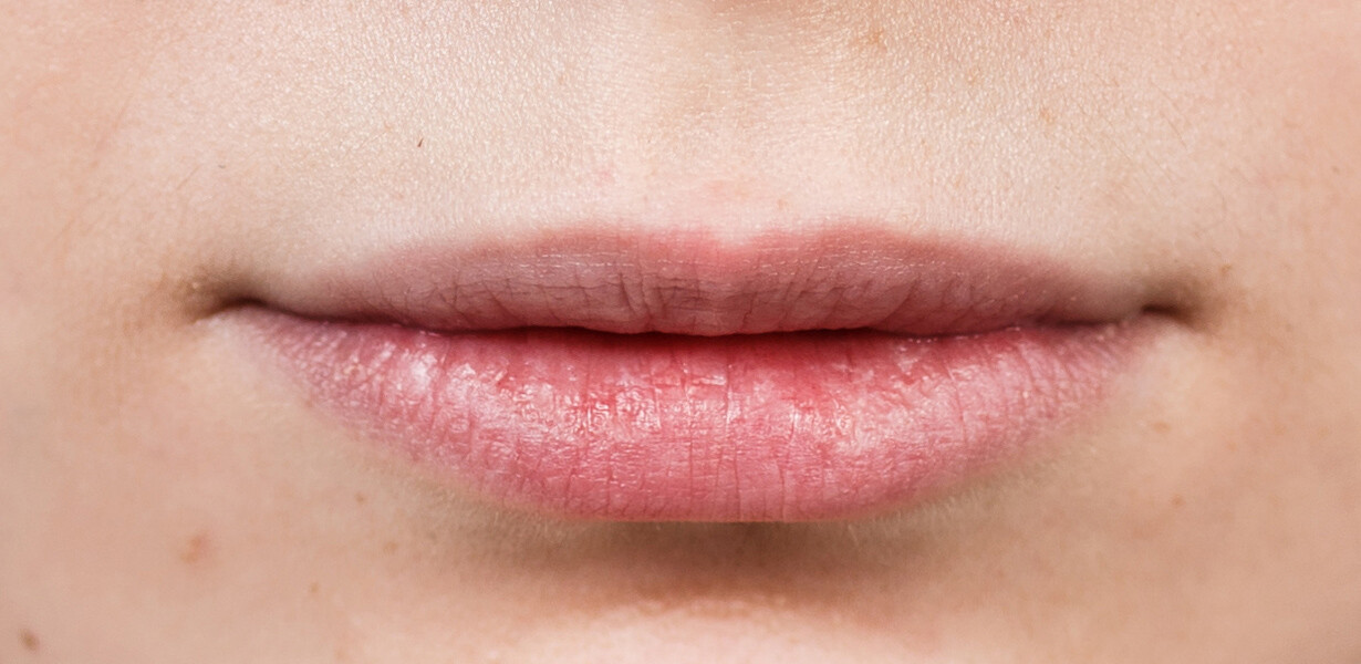 lips-before2 before lips Russian