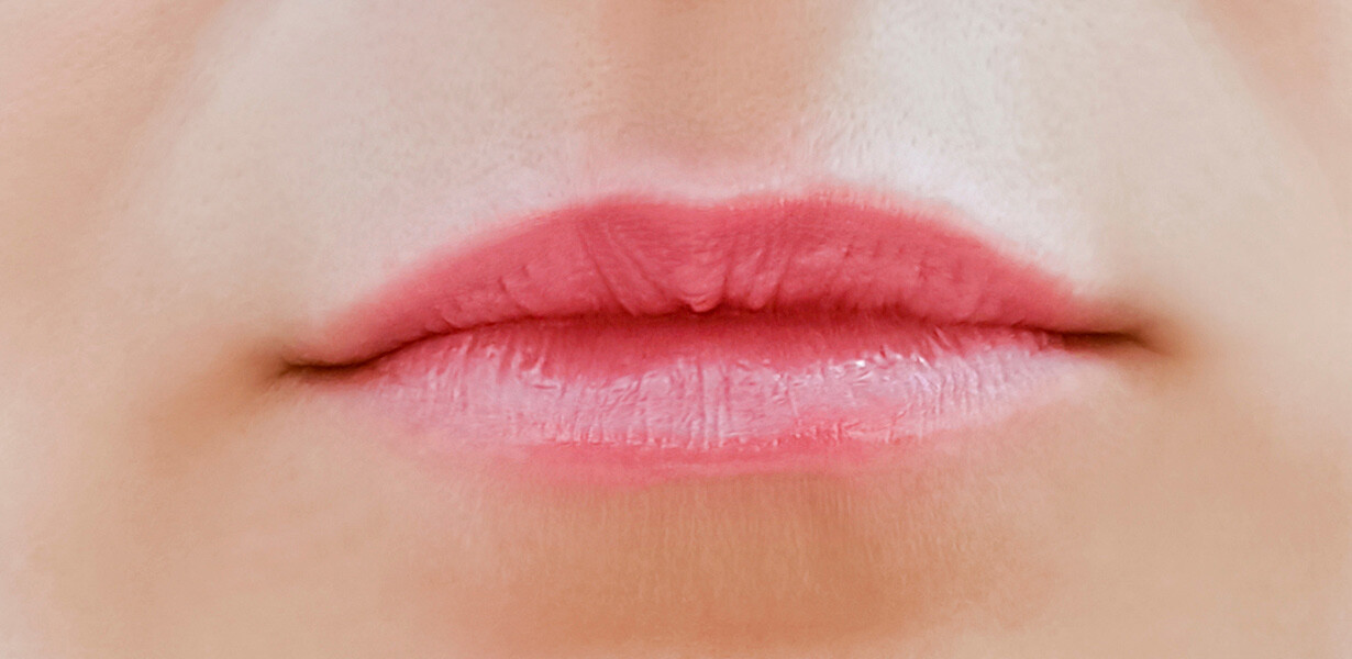 lips-before3 lips before3