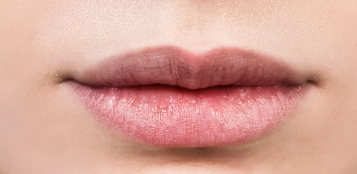 lips-after2-1.jpg