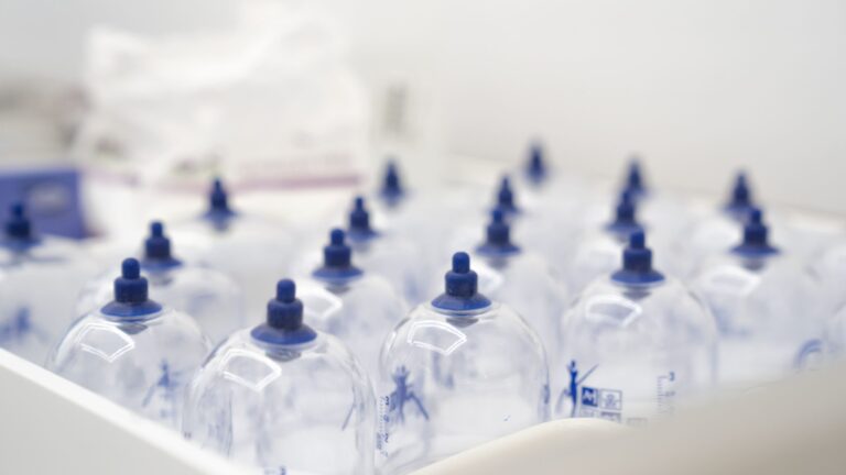 acupuncture-suction-cups-DNA-Health-Clinics-scaled.jpg