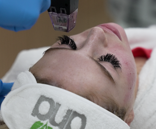 Morpheus8 pro at DNA Health
